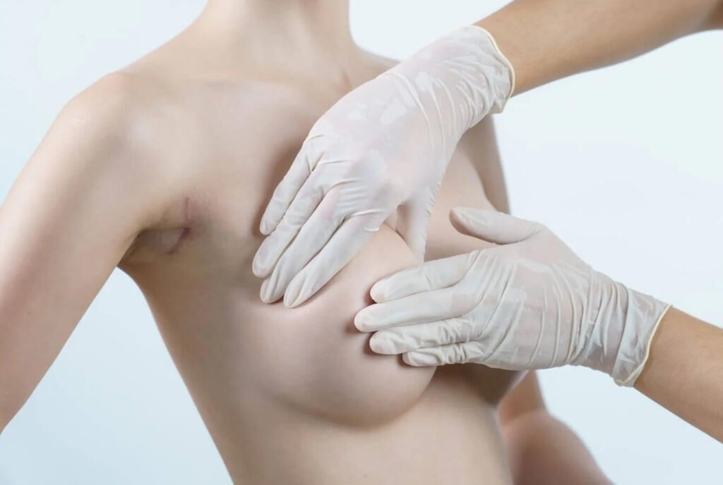 Breast Reduction