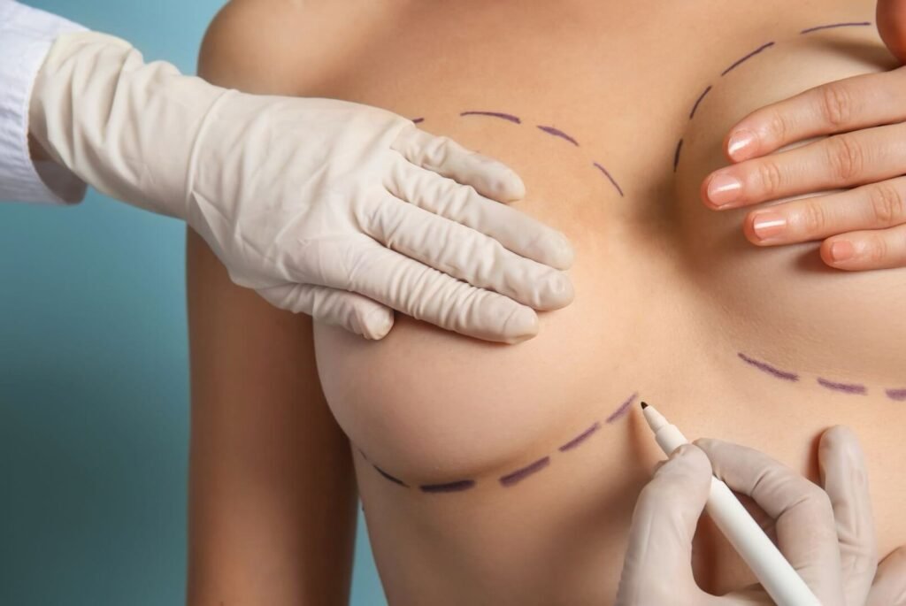 Aesthetic Breast Surgery