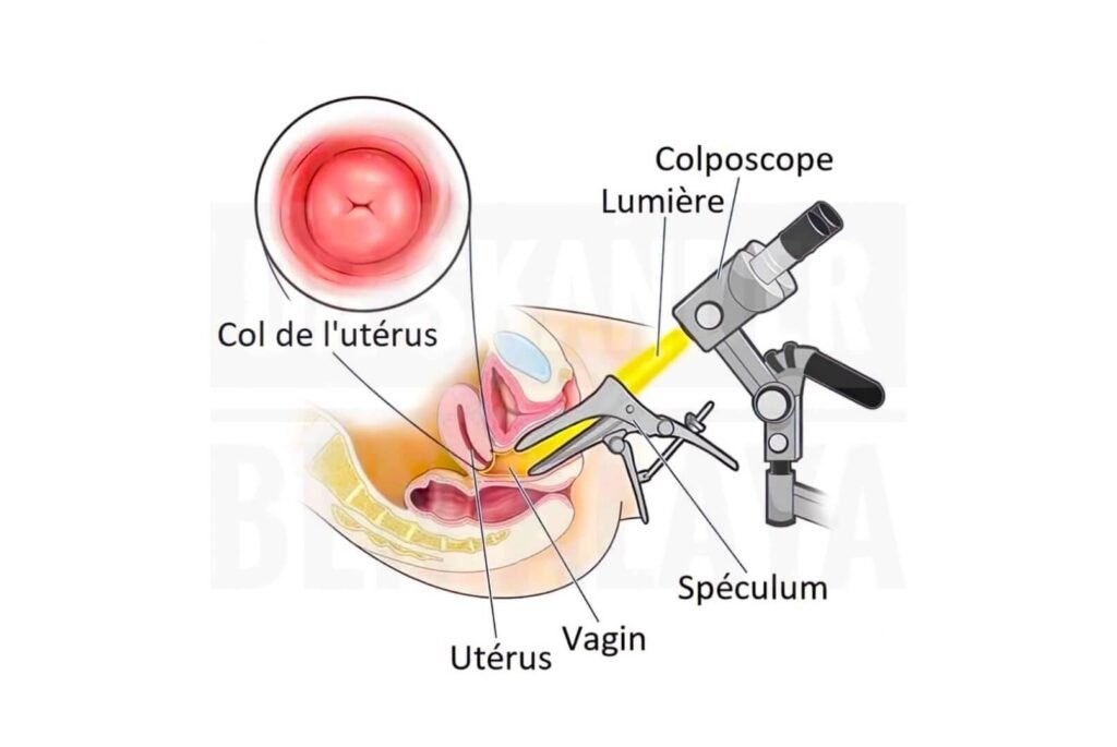Colposcopy