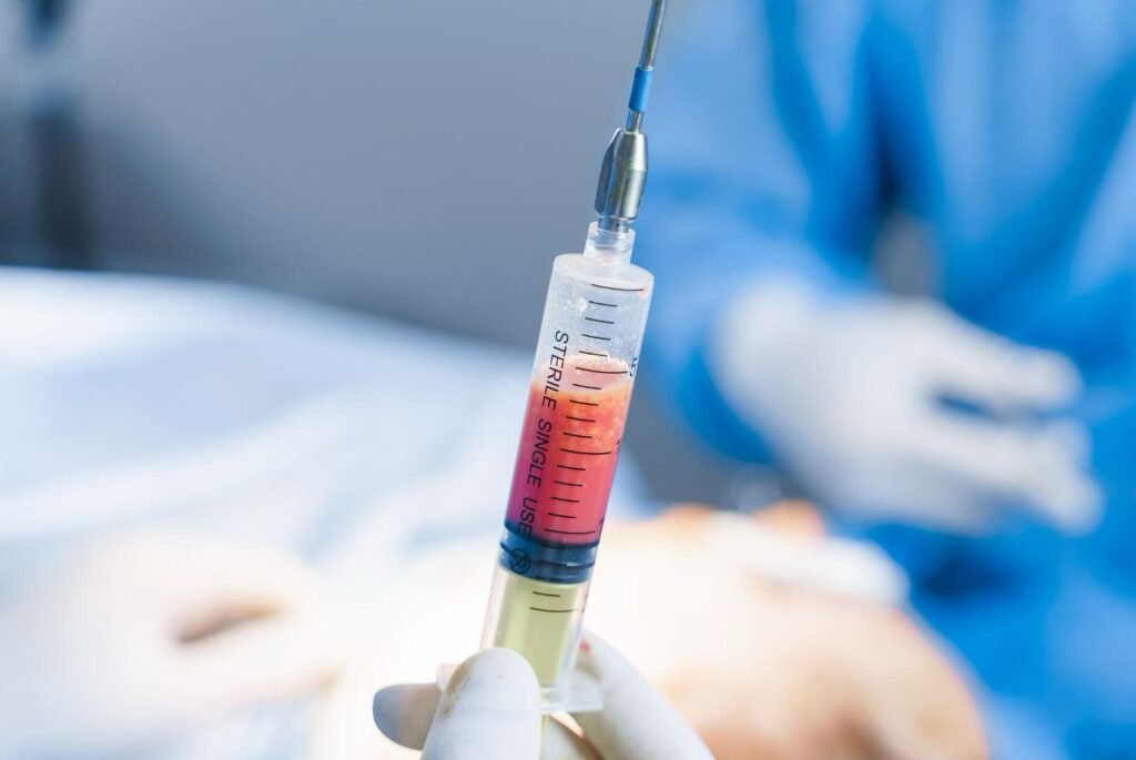 Lipofilling des Seins